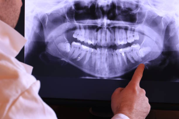 Best Emergency Gum Pain Relief  in Astor, FL